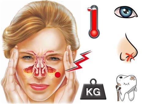 Симптомы кисты в носовой пазухе