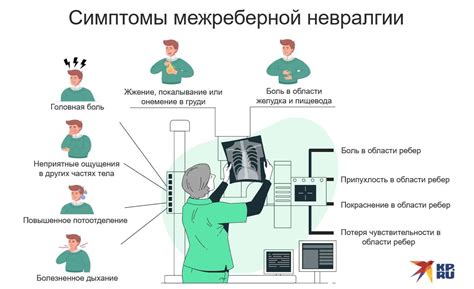 Симптомы межреберной невропатии у женщин