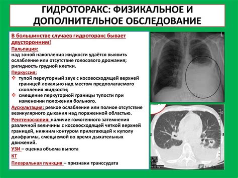 Симптомы наличия воды в легких