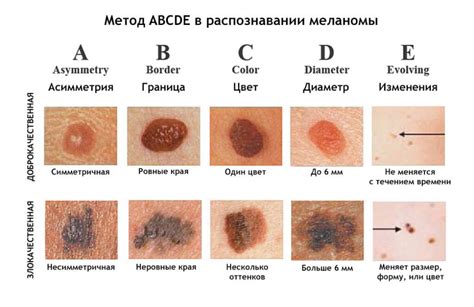 Симптомы наличия занозы в коже