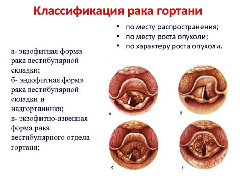 Симптомы опухания висцеральной петли глотки