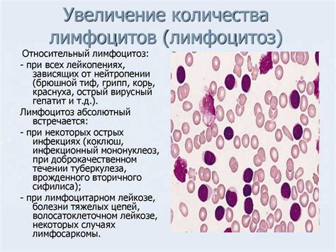 Симптомы повышенных лимфоцитов в процентах