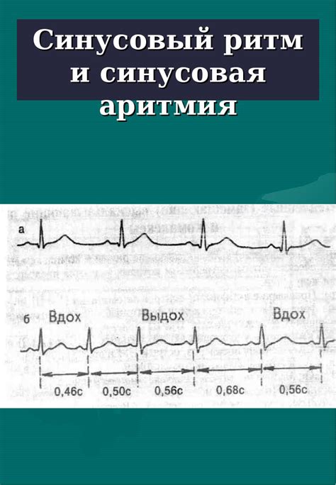 Симптомы синусового ритма: как распознать?