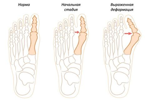 Симптомы шишки на кости после удара