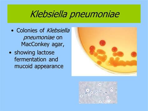 Симптомы Klebsiella pneumoniae в посеве