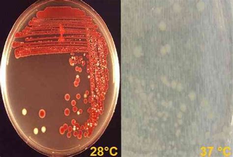 Симптомы Serratia marcescens в горле