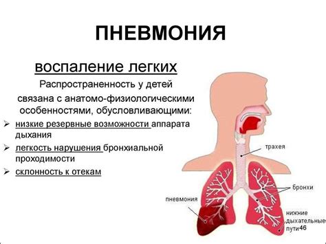 Слабость – главный симптом пневмонии у взрослых