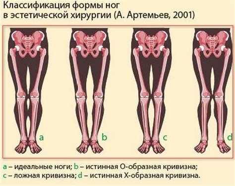 Сновидение о порванных между ног