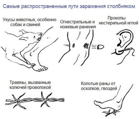 Собачий столбняк и его признаки