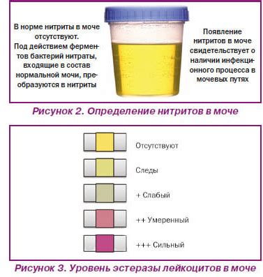 Советы по изменению цвета мочи