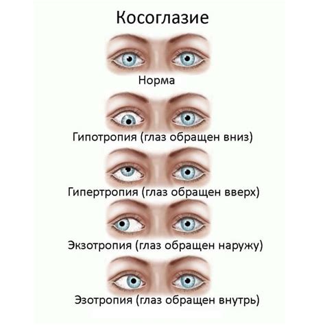 Советы по устранению чесания правого глаза в воскресенье вечером