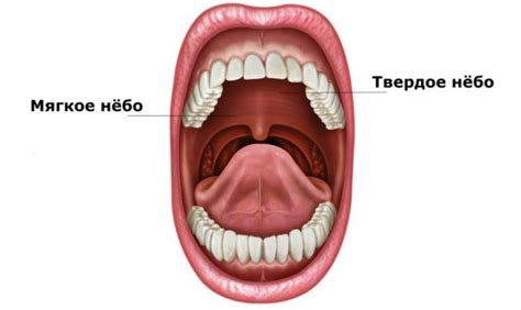 Способы лечения воспаления верхнего нёба