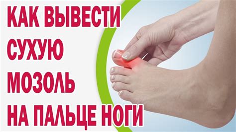 Способы снять сухую мозоль на пальце ноги