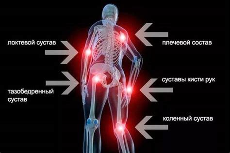 Способы устранения хруста суставов