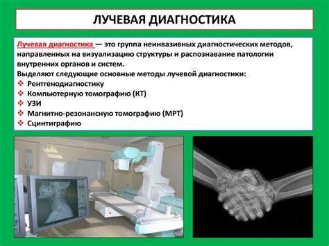 Сравнение методов диагностики пневмонии