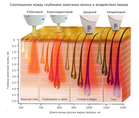 Сравнение методов удаления волос: что выбрать?