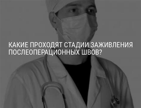 Сроки заживления швов: что ожидать