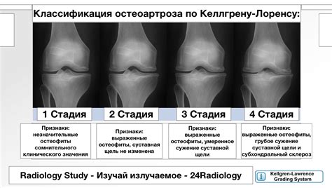 Стадия №1: Обнаружение повреждения