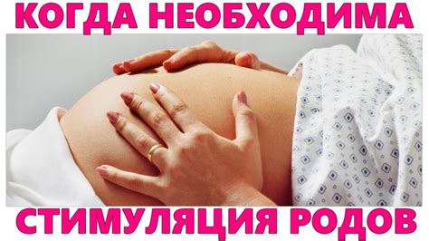 Стимуляция родов естественными способами