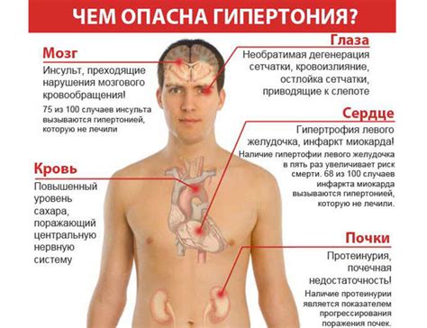 Стресс и гипертония 1 степени