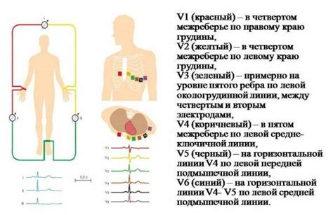 Техника проведения проверки ЭКГ