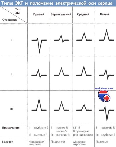 Типы Эос