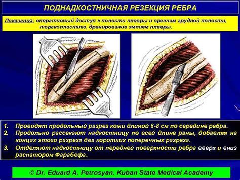 Травмы и операции на грудной клетке