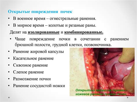 Травмы мочеполовых органов