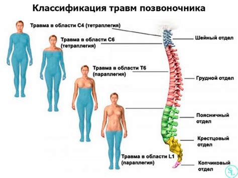 Травмы позвоночника и спинного мозга