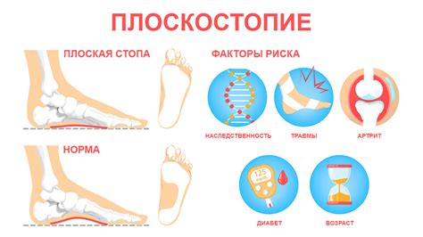 Третий фактор, испытывающий зуд в левой ноге в четверг