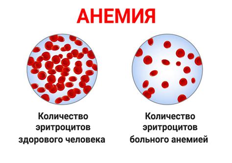 Угроза развития анемии