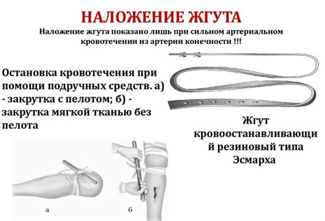 Удаление кровоостанавливающего жгута: что дальше?