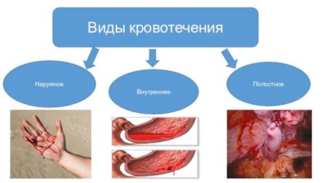 Уровень кровотечения и его причины