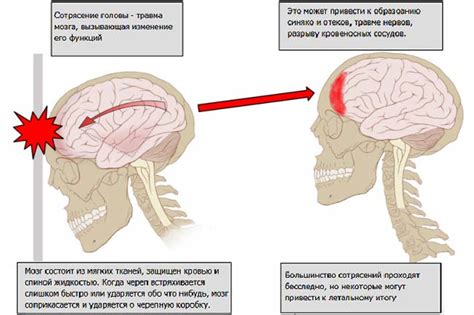 Уход за сотрясением мозга и головокружение: лучшие средства