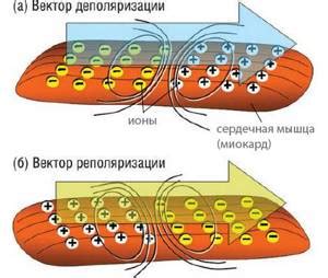 Физиологические последствия нарушения реполяризации