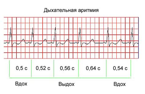 Физическая активность и дыхательная аритмия