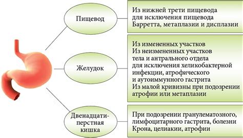 Фрукты и овощи для укрепления желудочно-кишечного тракта