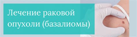 Хирургическое удаление базалиомы