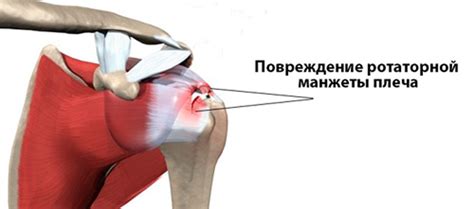 Чем вызвано зудение правого плеча в понедельник