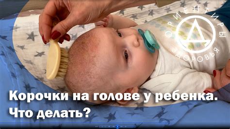 Что вызывает зуд на голове у детей?