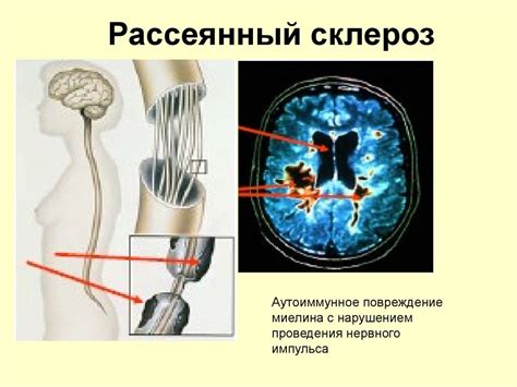 Что делать, если ощущается жжение в ногах ночью?