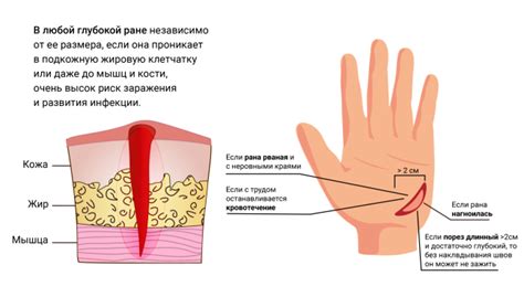 Что делать при глубокой ране на пальце?