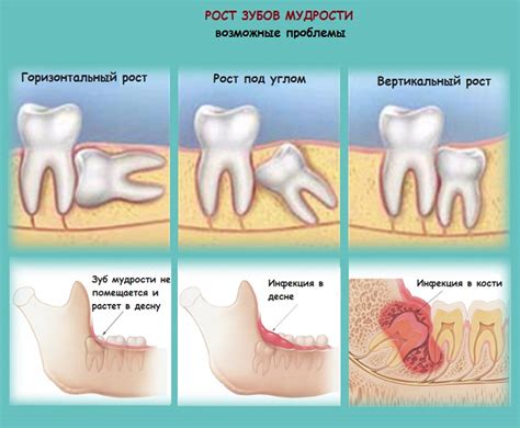 Что делать с голубём после его удаления?