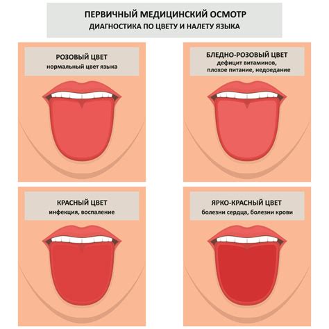 Что означает рисунок на языке у взрослого?