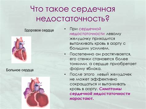 Что пить при недостаточности венозного кровообращения