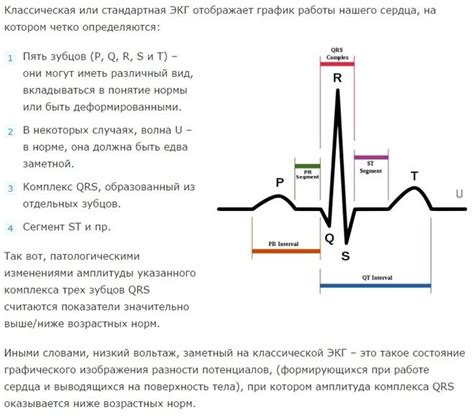 Что такое вольтаж на ЭКГ и для чего он нужен?