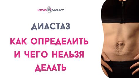 Что такое диастаз и как он выглядит?