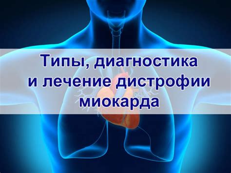 Что такое дистрофия миокарда?