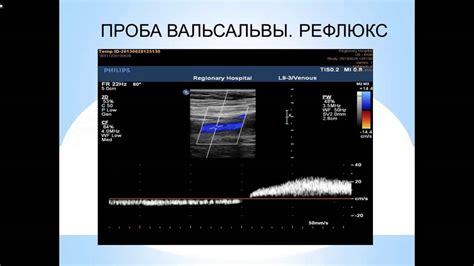 Что такое доплеровское обследование сосудов нижних конечностей?