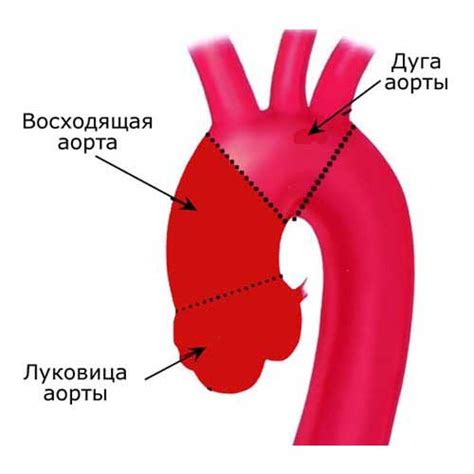 Что такое кардио-диафрагмальные синусы?